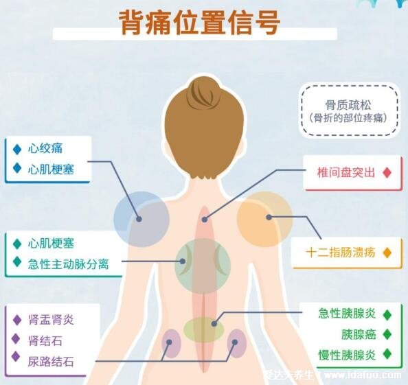 背部筋膜炎疼痛位置图，身体背部各部位疼痛对比图