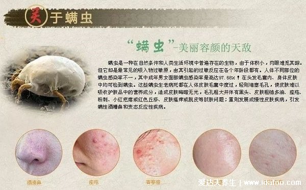 床上螨虫咬的症状图片，似蚊子包夜晚比白天瘙痒(螨虫最怕这3种东西)