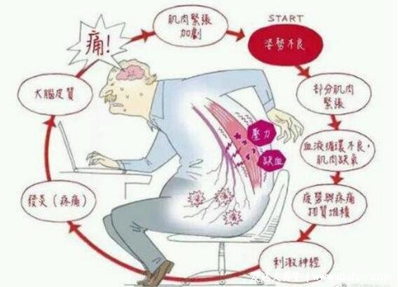 背部筋膜炎疼痛位置图，身体背部各部位疼痛对比图