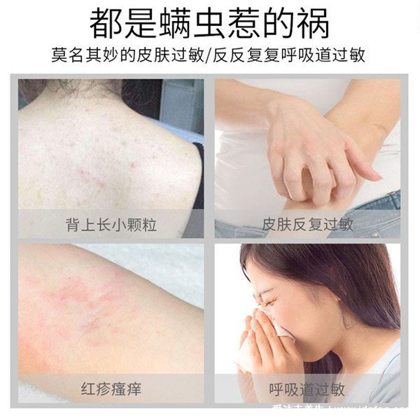 螨虫过敏症状图片，可打喷嚏等似感冒/被咬身上瘙痒(叮咬图)