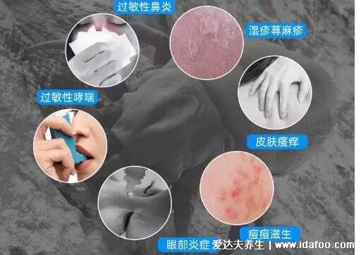 螨虫过敏症状图片，可打喷嚏等似感冒/被咬身上瘙痒(叮咬图)
