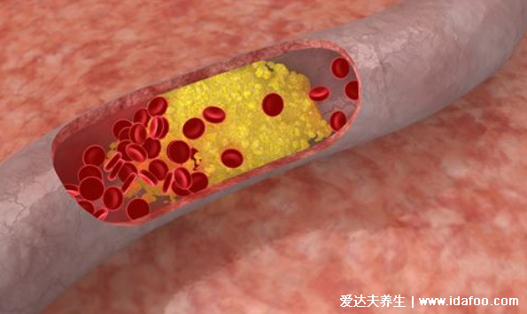 你还在减肥？体重低当心 5种病找上门