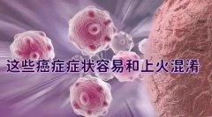 肋骨疼是癌症早期信号(你以为你接受谁的