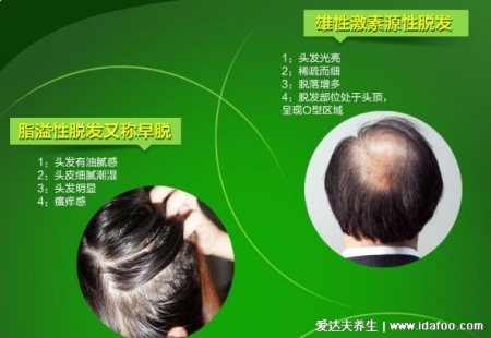 仁和匠心防脱育发液效果怎么样，央视已曝光大家擦亮眼睛