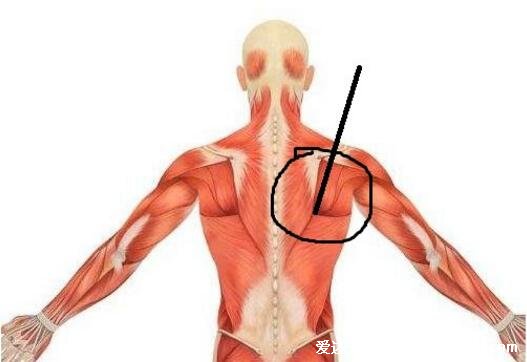 背部筋膜炎疼痛位置图，身体背部各部位疼痛对比图