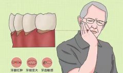 老年人牙龈萎缩最佳治疗方法(老年人牙龈